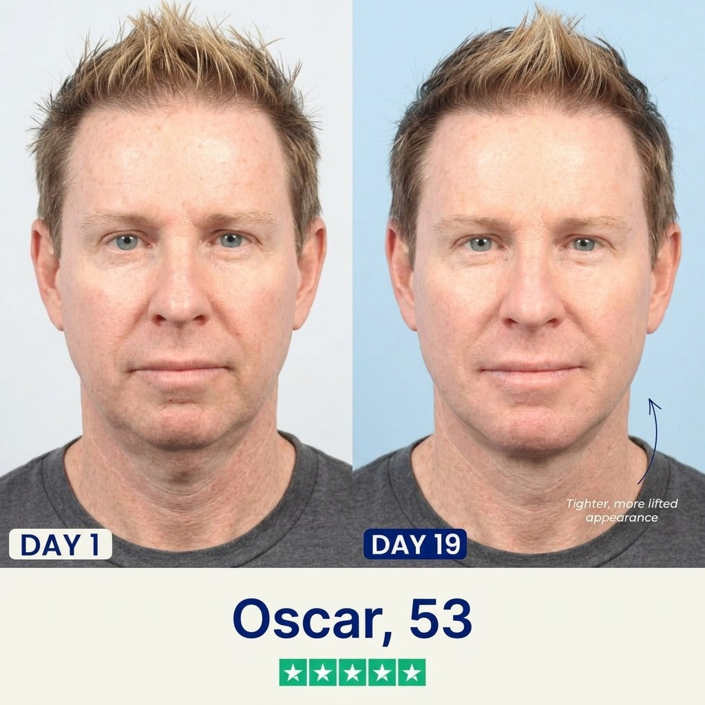 vLift Jawline Sculptor